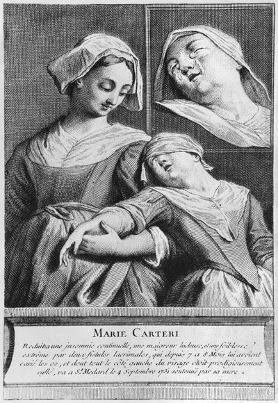 Cudowne uzdrowienie niewidomej Marie Carteri na grobie diakona Francois de Paris na cmentarzu parafialnym Saint-Medard w Paryżu autorstwa French School