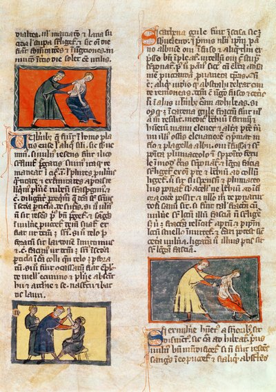 Ms H 89 fol.17r Chirurgia, z wydania „Księgi Chirurgii” Rogiera de Salerne autorstwa French School