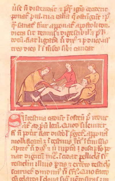 Ms H 89 fol.23 Chirurgia, z wydania Księgi Chirurgii Rogiera de Salerne autorstwa French School