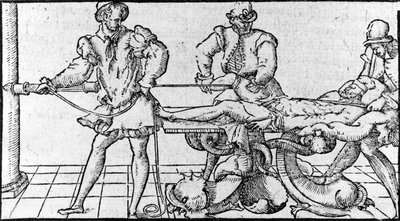 Redukcja zwichnięć, -w „Traktacie Medycznym Ambroise Paré”, ok. 1560. autorstwa French School