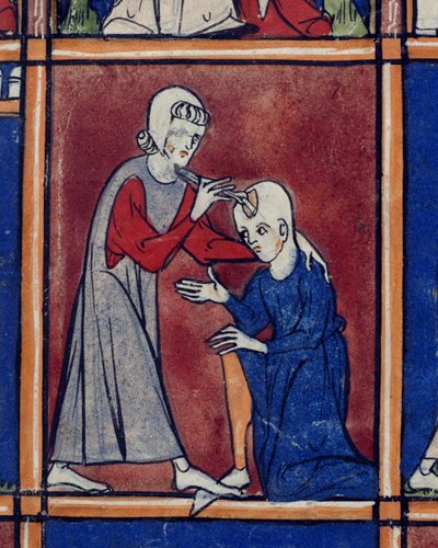 Sloane 1977 f.2 Operacja na czaszce pacjenta, ilustracja z „Chiurgia”, Roger Frugardi z Parmy, ok. 1300-10 (welum) autorstwa French School