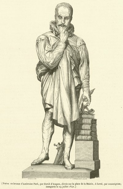 Spiżowa statua Ambroise Pare (rycina) autorstwa French School