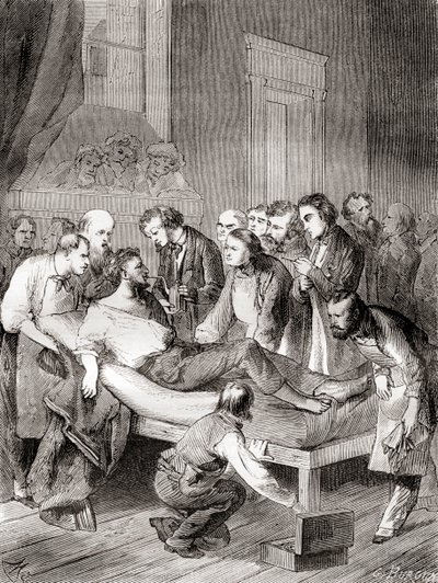 Pierwsza publiczna demonstracja użycia wziewnego eteru jako chirurgicznego środka znieczulającego w 1846 r. przez amerykańskiego dentystę Williama Thomasa Greena Mortona z „Les Merveilles de la Science”, opublikowana ok. 1870 r. autorstwa French School