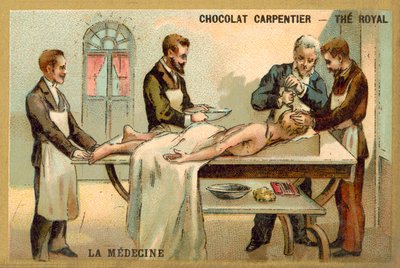 Trepanowanie (chromolitho) autorstwa French School