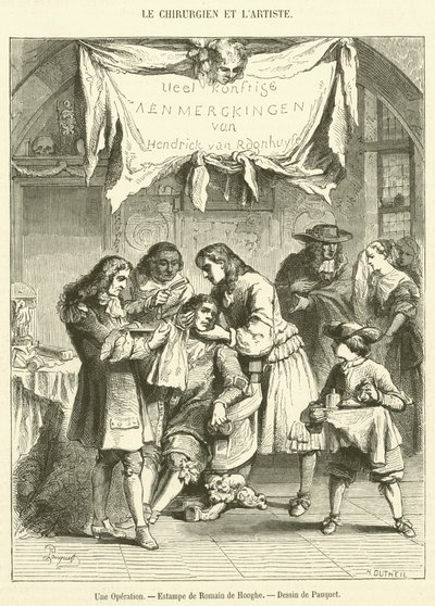 Operacja (grawerowanie) autorstwa French School