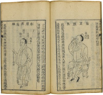 Shen Shi Yao Han Cenna księga okulistyki, 1644 autorstwa Fu Renyu