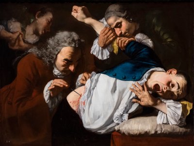 Operacja, około 1753/54 (olej na płótnie) autorstwa Gaspare Traversi