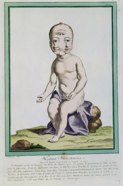 Dziecko ze zdeformowaną głową, z „Les Ecarts de la Nature”, Paryż, 1775 autorstwa Genevieve Regnault de Nangis