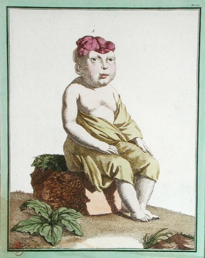 Dziecko z połową głowy, z „Les Ecarts de la Nature”, Paryż autorstwa Genevieve Regnault de Nangis