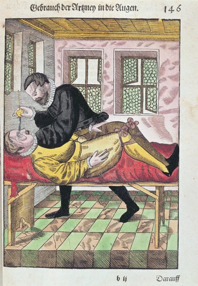 Operacja oka z Ophthalmodouleia Georga Bartischa (1535-1636) wydana w Dreźnie w 1583 r. (kolorowy drzeworyt) autorstwa German School