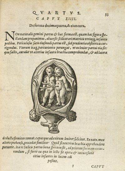 Nieidentyczne bliźnięta w łonie matki, ilustracja z rozdziału 14, księga 4 O poczęciu i rozwoju człowieka Rueffa, 1587 autorstwa German School