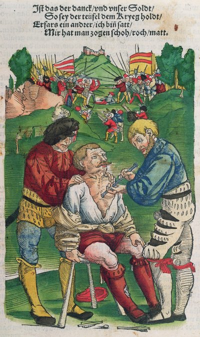 Usunięcie strzały, ilustracja z Feldtbuch der Wundartzney autorstwa Hansa von Gersdorffa, 1540 autorstwa German School