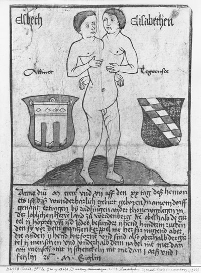 Dziewczęta syjamskie, Elsbeth i Elisabethen (drzeworyt i toaleta) autorstwa German School