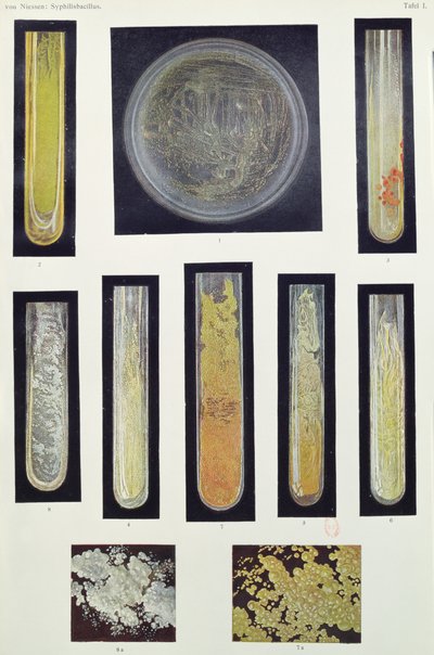 Syfilis Bacillus, z książki Maxa von Niessena, Lipsk, 1908 autorstwa German School