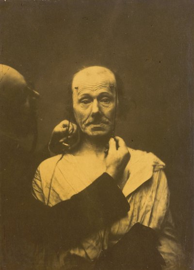 Uwaga autorstwa Guillaume Benjamin Amant Duchenne