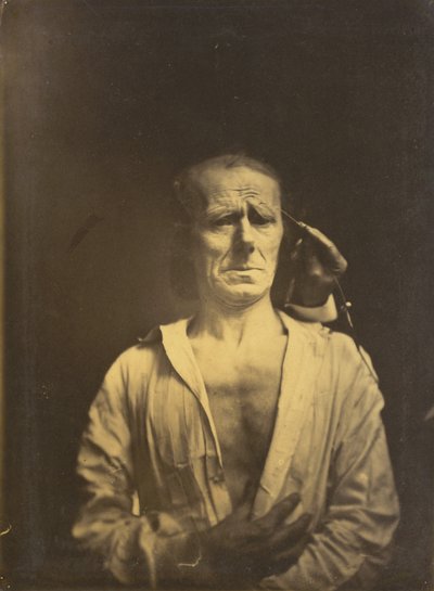Skurcz m.in. tektura falista supercilii pod bardzo silnym światłem (po lewej); Zrelaksowana twarz (sfotografowana w pełnym słońcu) (po prawej) autorstwa Guillaume Benjamin Amant Duchenne
