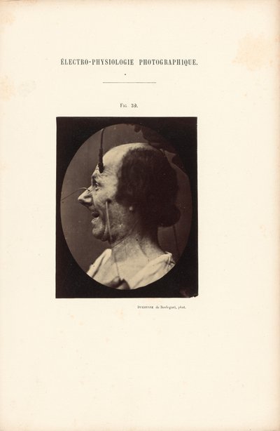 Elektrofizjologia fotograficzna, rysunek 39 autorstwa Guillaume Benjamin Duchenne