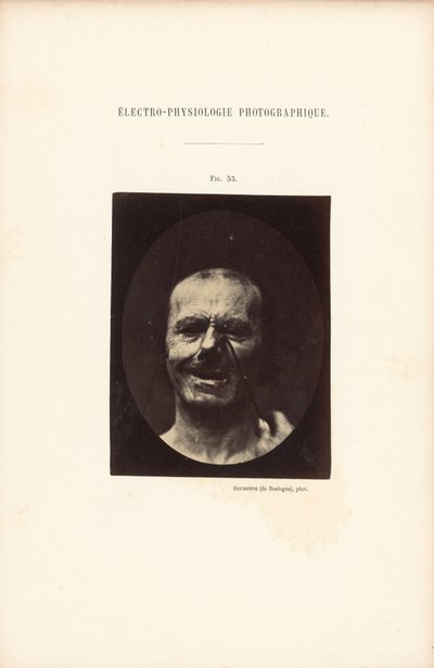 Elektrofizjologia fotograficzna, rysunek 53 autorstwa Guillaume Benjamin Duchenne