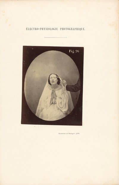 Elektrofizjologia fotograficzna, rysunek 76 autorstwa Guillaume Benjamin Duchenne