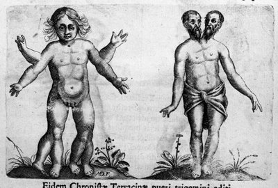 Różne typy ludzkich potworów Rycina z „Natury potworów, ich przyczyn i różnic” autorstwa Fortunio Chociaż (1577-1656), włoskiego naukowca. 1646 autorstwa Italian School
