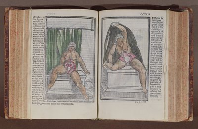 Anatomia kobiety, z komentarzy do anatomii świata z najwspanialszymi dodatkami, autorstwa Jacopo Berengario da Carpi (ok.1460-ok.1530) opublikowanych w Bolonii, 1521 (kolorowy drzeworyt) autorstwa Italian School