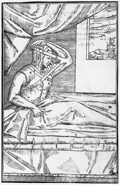 Chirurgia rekonstrukcyjna nosa, ilustracja z De curtorum chirurgia per insitionem Gaspare Tagliacozziego (1545-99) Wenecja, opublikowana 1597 autorstwa Italian School