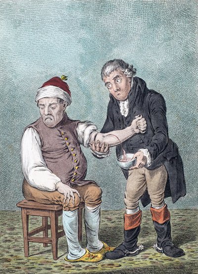 Puszczanie krwi. Puszczanie krwi. (wydrukować) autorstwa James (after) Gillray