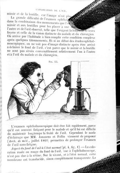 Ilustracja z „Traite Pratique des Maladies des Yeux”, tłumaczenia „Podręcznika zasad i praktyki medycyny i chirurgii okulistycznej”, Thomasa Whartona Jonesa (1808–91), autorstwa E. Fouchera, opublikowanego w Paryżu 1862 (rycina) (b /w zdjęcie) autorstwa Jean Francois Badoureau