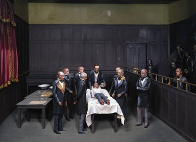 Anesthetists at Work (premiera operacja avec anesthesie, anesthesis) autorstwa Unbekannt Unbekannt