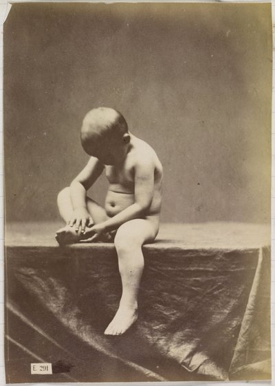 Badanie nagiego, siedzącego dziecka autorstwa Louis Jean Baptiste Igout (attributed to)