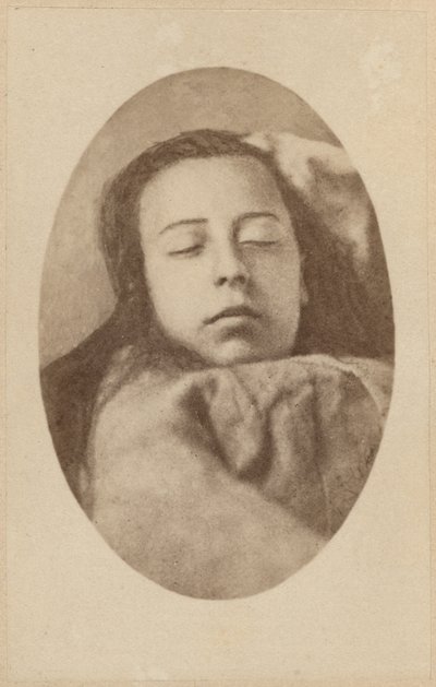 Atak histerii, faza druga, ilustracja z „Iconographie Photographique de La Salpetriere” Bourneville i P. Regnard, płyta III, Paryż, 1876 (druk albumowy) autorstwa Paul Regnard