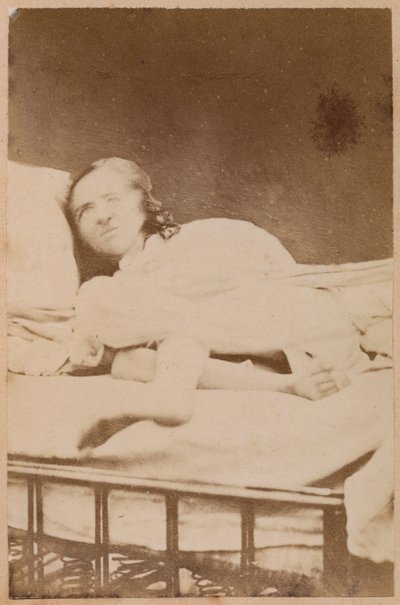 Epilepsja histeryczna, wykrzywienia, klisza XXXVIII z „Iconographie Photographique de La Salpetriere” Bourneville i P. Regnard, Paryż, 1876 (druk albumowy) autorstwa Paul Regnard