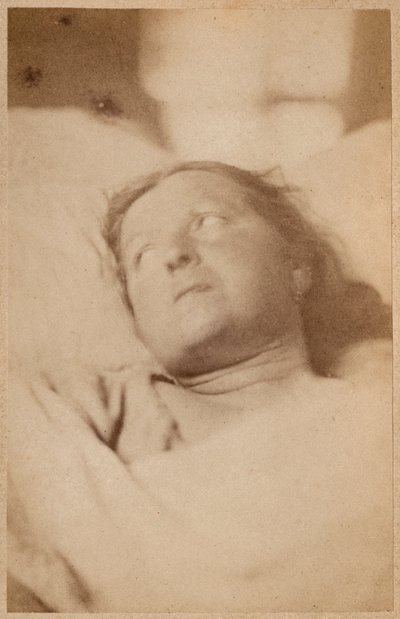 Epilepsja histeryczna, ukrzyżowanie, postawa głowy, tablica VII z „Iconographie Photographique de La Salpetriere” Bourneville et P. Regnard, Paryż, 1876 (druk albumowy) autorstwa Paul Regnard