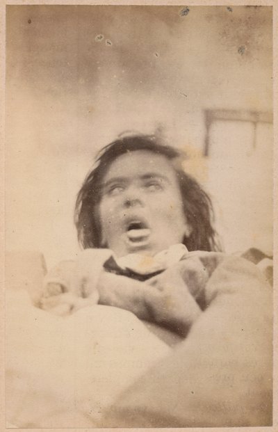 Epilepsja histeryczna, halucynacje, udręka, płyta XXIX z „Iconographie Photographique de La Salpetriere” Bourneville