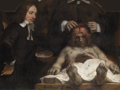 Lekcja anatomii dr Jana Deymana, 1656 autorstwa Rembrandt van Rijn