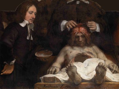 Lekcja anatomii dr Jana Deijmana, 1656 r. autorstwa Rembrandt van Rijn