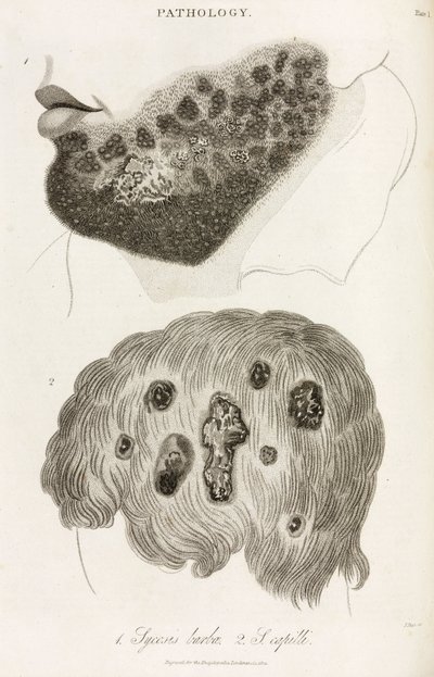 Dermatologia Choroby skóry autorstwa John Pardon