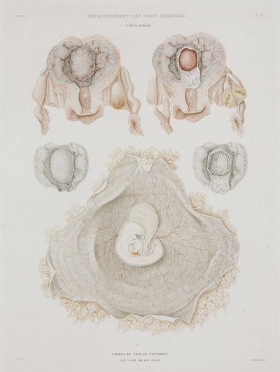 Ginekologia Ludzka macica z zarodkiem, ok. 1847-1859 autorstwa John Pardon