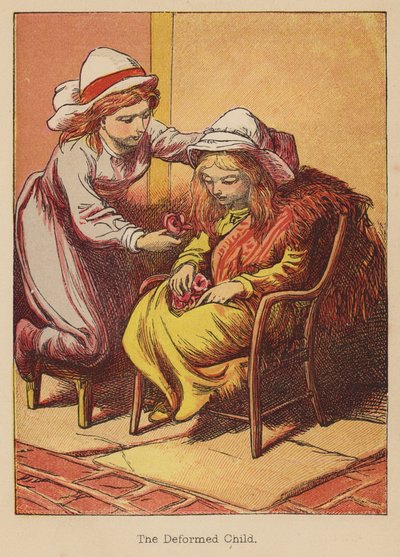 Zdeformowane dziecko (kolorowa rycina) autorstwa Thomas Dalziel