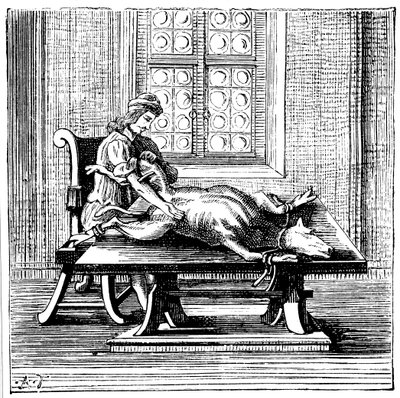 Transfuzja krwi od zwierzęcia do człowieka, 1679 autorstwa Unbekannt