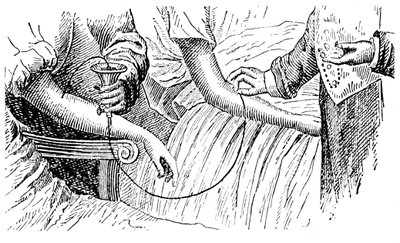 Transfuzja krwi, c1880 autorstwa Unbekannt