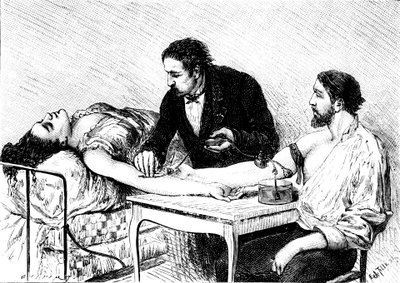 Dr Roussell z Genewy poddający kobiecie bezpośrednią transfuzję krwi od wolontariusza, 1882 r. autorstwa Unbekannt