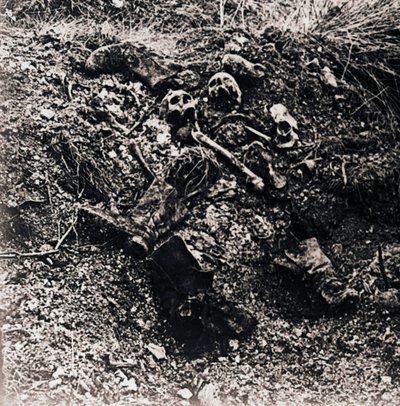 Szczątki ludzkie, c1914-c1918 autorstwa Unbekannt