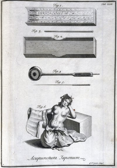 Medycyna alternatywna: tabliczka przedstawiająca igły do ​​akupunktury i ich zastosowanie, grawer z „Historii Japonii” (1727) Engelberta Kaempfera (1651-1716) (Igły do ​​akupunktury i ich zastosowanie, ok. 1690 Grawer G van der Gucht fig. autorstwa Unbekannt