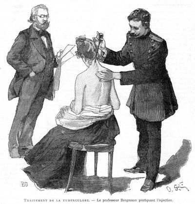 Profesor Bergmann wstrzykuje pacjentowi gruźlicę, 1891 autorstwa Unbekannt