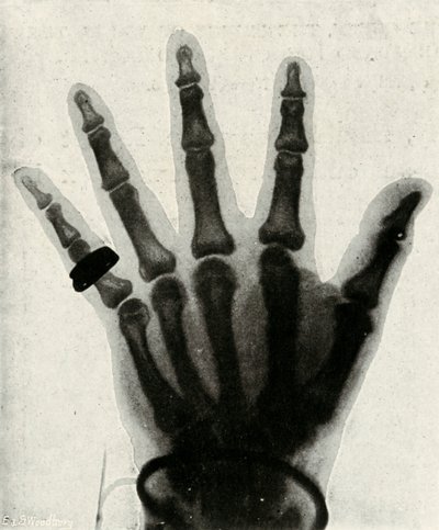 Radiogram ręki H.R.H. Książę Walii, c1897 autorstwa Unbekannt