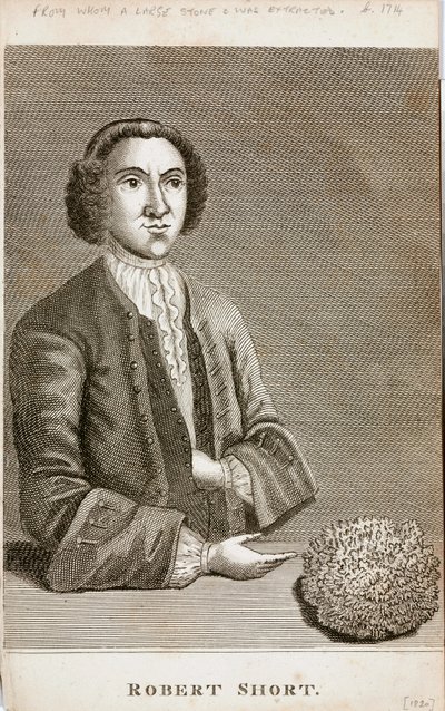 Robert Short, ciekawostka medyczna, ok. 1750 autorstwa Unbekannt