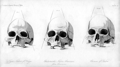 Trzy rodzaje ludzkiej czaszki, 1848 autorstwa Unbekannt