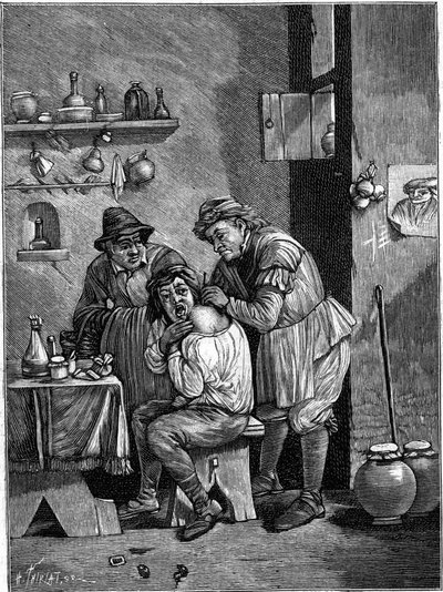 Szarlatan chirurg w XVIII wieku badający uraz barku. (Z grawerunku czasu). Grawerowanie w „”La Nature: revue des sciences et de leurs applications aux arts et a l
