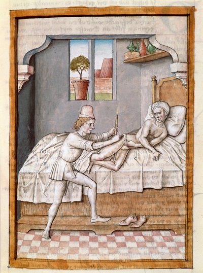 Lekarz leczy miniaturowego pacjenta z niemieckiego tłumaczenia bajek „Kalila (Calila) i Dimna” Bidpaia. (ms. 1389, k. 23) ok. 1480 Chantilly, muzeum Conde autorstwa Unknown artist